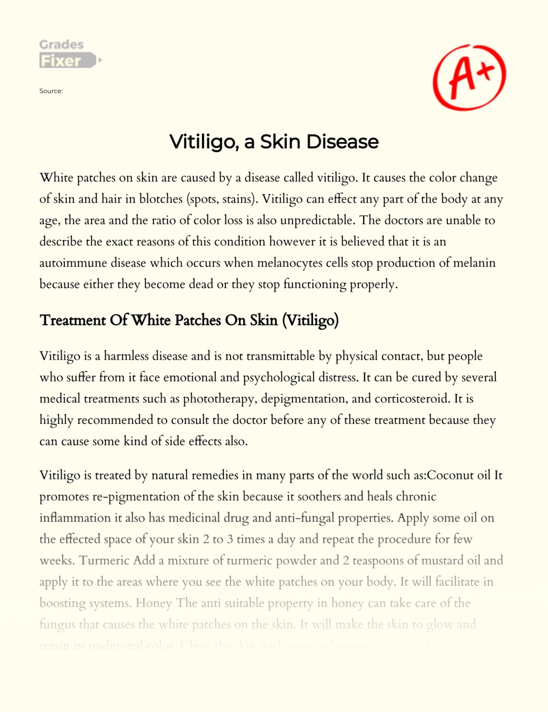 Vitiligo, a Skin Disease essay