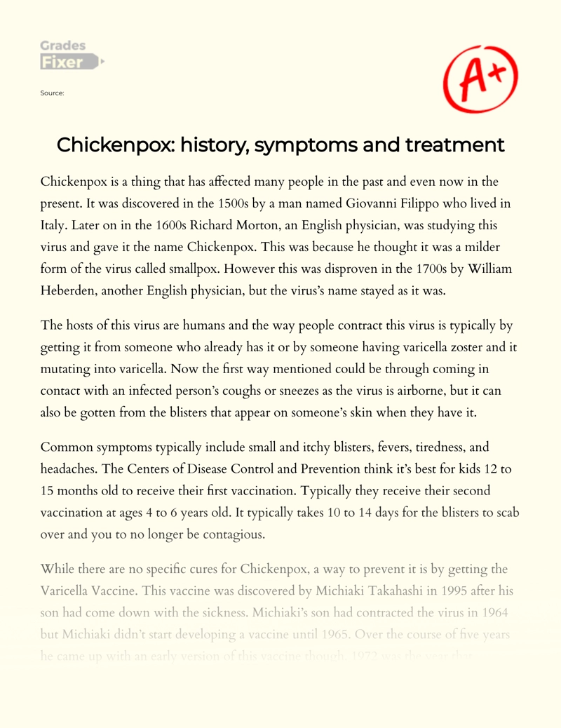 Chickenpox: History, Symptoms and Treatment Essay